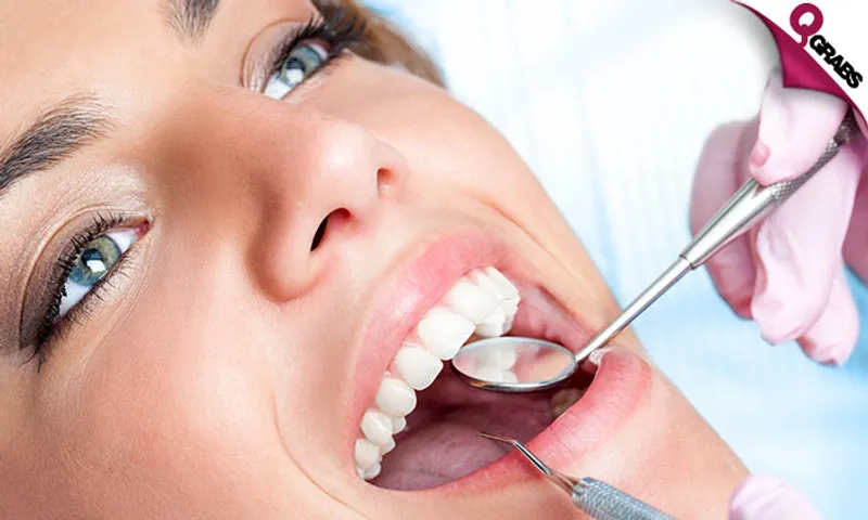 Teeth Scaling, Polishing, Consultation & More!